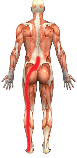 What is the Difference Between Piriformis Syndrome vs Sciatica?